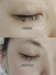 -雯婷·美容养生