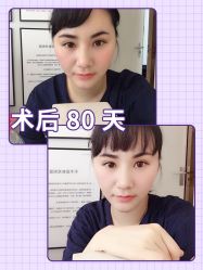 -广东韩妃整形外科医院