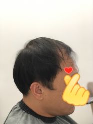 -发饰美男士增发补发假发定制店