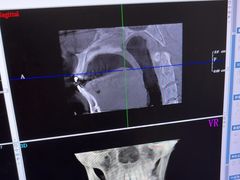 -土豆口腔(凤凰北总店)