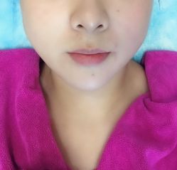 -北京米扬丽格医疗美容·联合丽格鼻整形中心