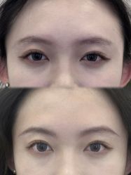 -杨益美学·野生眉半永久纹眉发际线