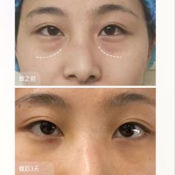 -紫洁俪方（北京）医疗美容