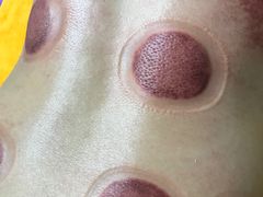 -沈师傅盲人按摩工作室(密三小区店)