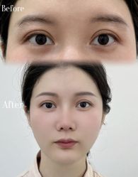 -AM半永久纹眉