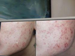 -苑苑vbeauty科技美容SPA