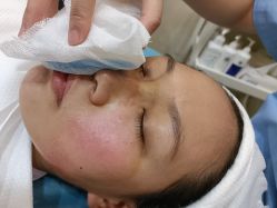 体验后-德媛医疗美容