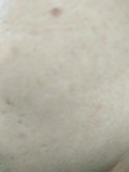 -清颜堂丨分子祛痘·功效美肤