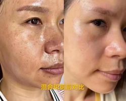 -美愈美肤MEIYU SKIN