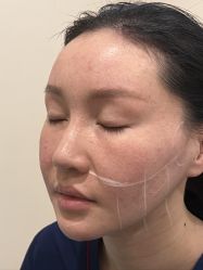 -北京米扬丽格医疗美容·联合丽格鼻整形中心