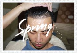 -大麦微针植发全国连锁