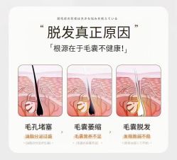 -希梵尔头皮抗衰·科技养发