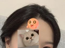 -大麦微针植发全国连锁