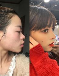 点击看大图 -深圳美莱医疗美容医院