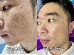 -蕾特恩专业祛痘·皮肤管理