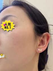 -长沙雅美医疗美容医院