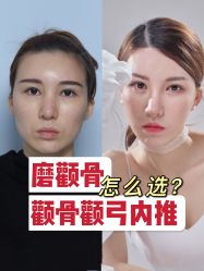 -大华韩艺整形美容医院