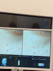 -苑苑vbeauty科技美容SPA