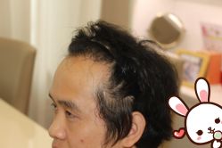 -大麦微针植发丨全国连锁