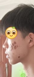 点击看大图 体验后-铂特丽医美·眼鼻整形·光电美肤·注射抗衰