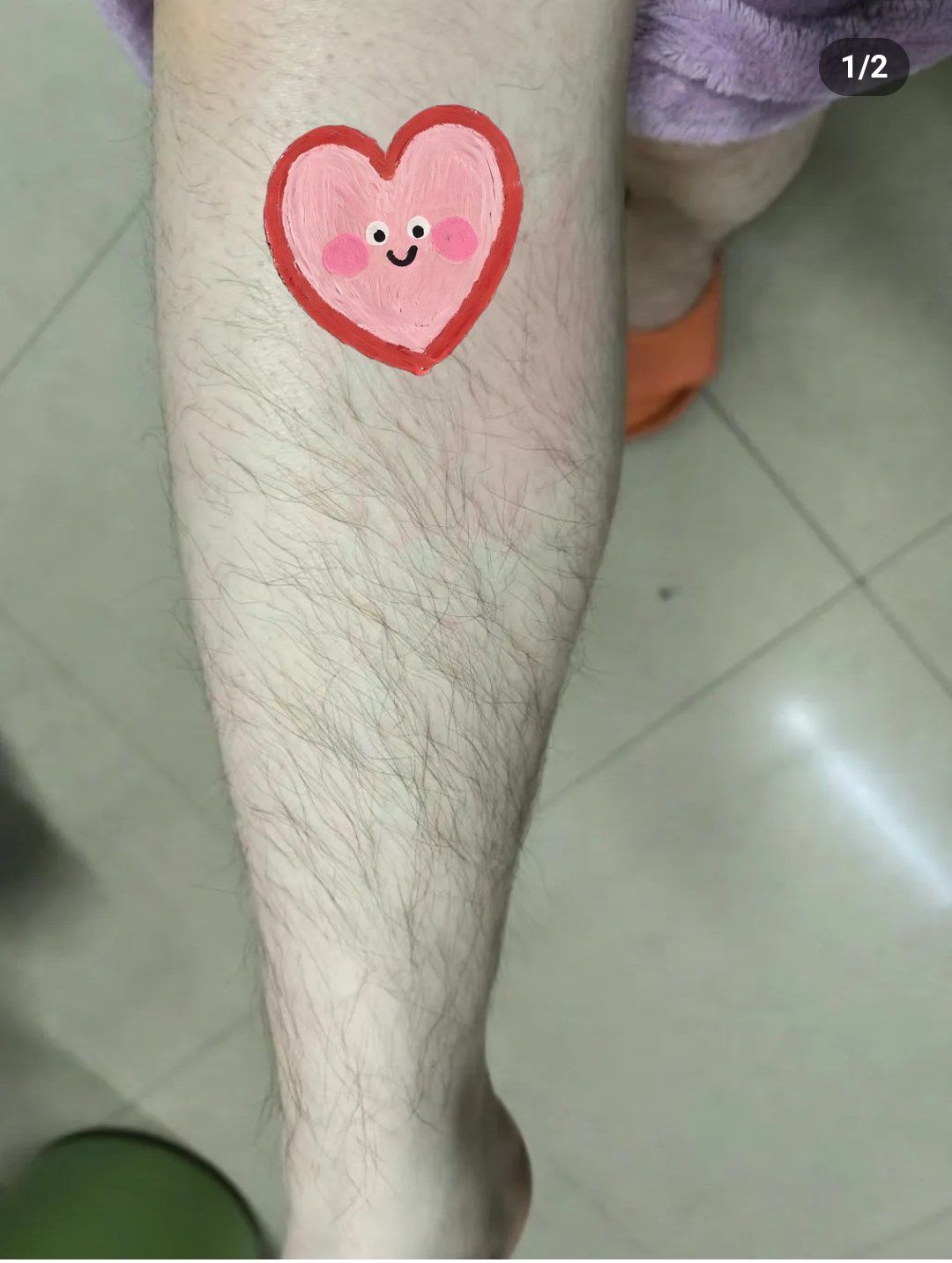 小腿脱毛毛