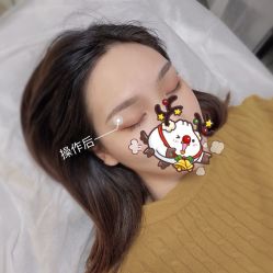 -YIMEI ART半永久纹眉·野生眉