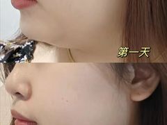 -大视光学•LINDBERG林德伯格•全球手工眼镜集合店(王府井店)