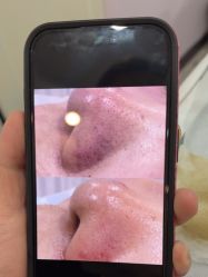 -SKIN79皮肤管理中心