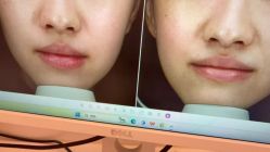 -苑苑vbeauty科技美容SPA