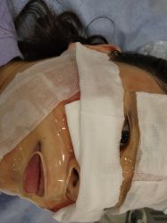 体验后-上海首尔丽格医疗美容医院