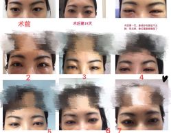 -八大处整形