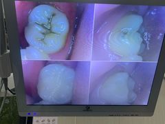 -同步齿科·数字化正畸种植口腔中心(前山店)