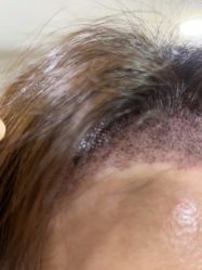 -熙朵美学植发·连锁品牌