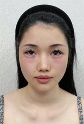 -广州曙光医学美容医院
