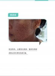 -慕拉美甲美睫皮肤管理