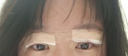 体验后-Dr.U博士医疗美容医院