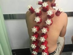 -孟氏拔罐(纬一路店)