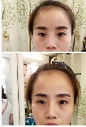 韩式半永久平眉-平萍纹绣韩式半永久定妆