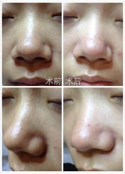 脸部抗衰-光SPA科技美肤