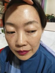 -北京美痣堂古方祛痣斑疣瘊