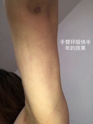-Yestar艺星医疗美容医院