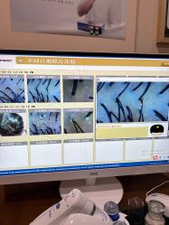 -丝客富脱发养发头皮馆