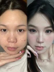 -上海伊莱美医疗美容医院