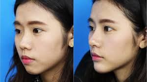 -SKINIST丽铂医疗美容