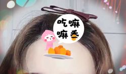 -大麦微针植发全国连锁