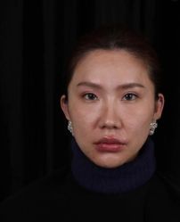 -武汉五洲整形外科医院