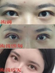 -南宁华美医疗美容医院