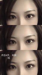 -美莱医学美容医院