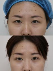-广州健丽·去眼袋医疗美容机构