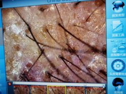 -雍禾植发全国连锁